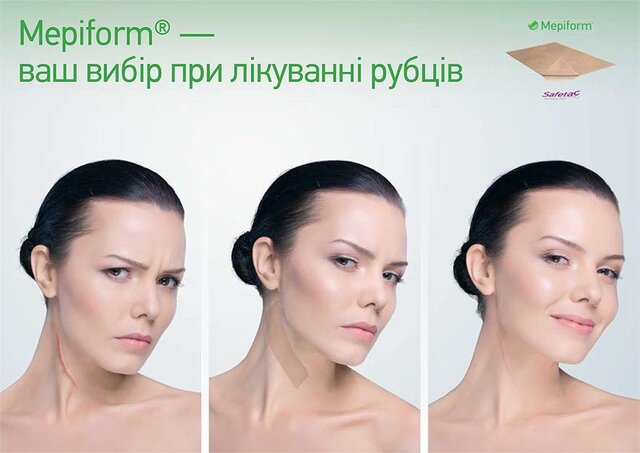 Фотореклама лечебного пластыря